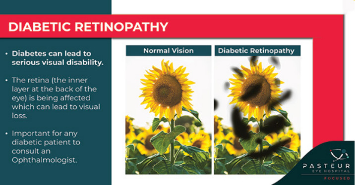 Diabetic Retinopathy